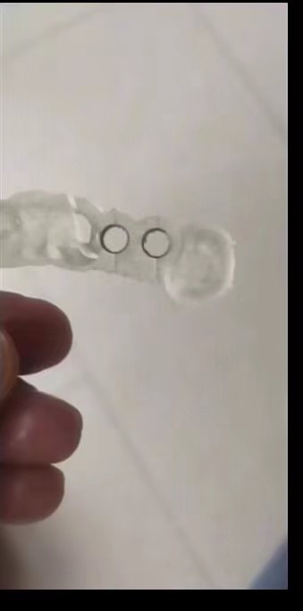 Hars Tandheelkundige 3D-printe - 3D Printing Dental recensie en prijs