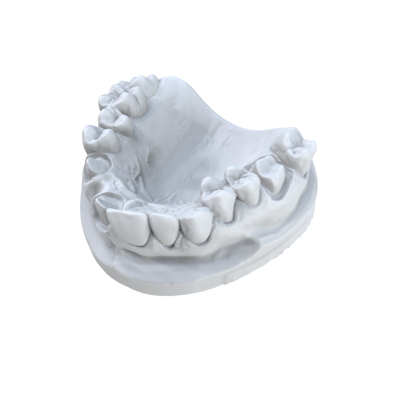 1 PCS Tandheelkundig Model Voo - 3D Printing Dental recensie en prijs