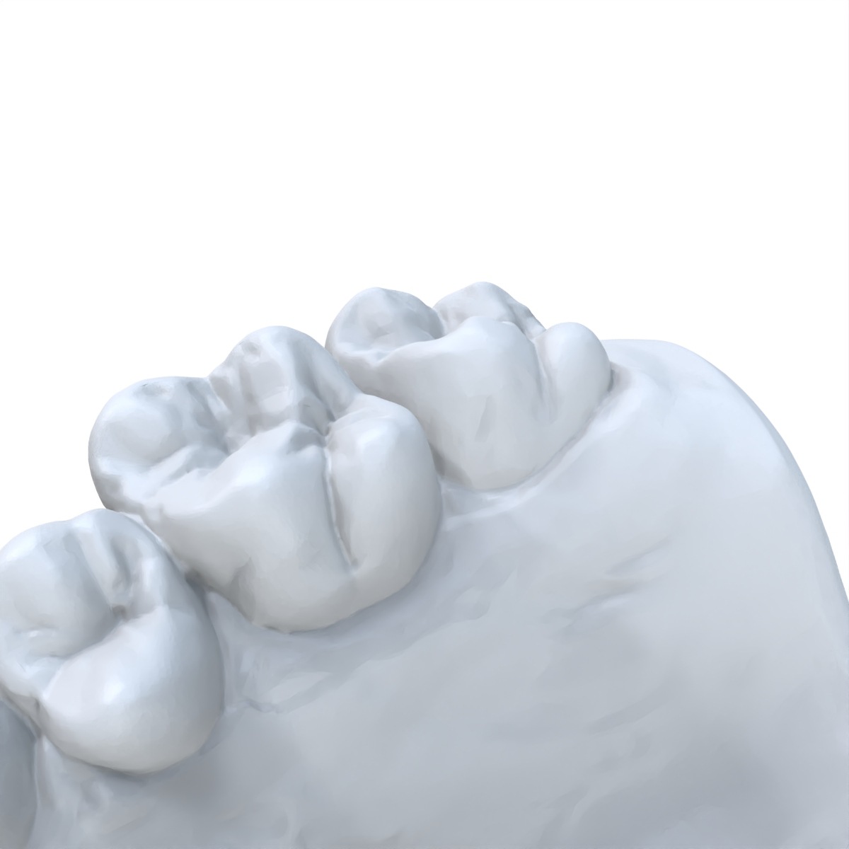 1 PCS Tandheelkundig Model Voo - 3D Printing Dental recensie en prijs